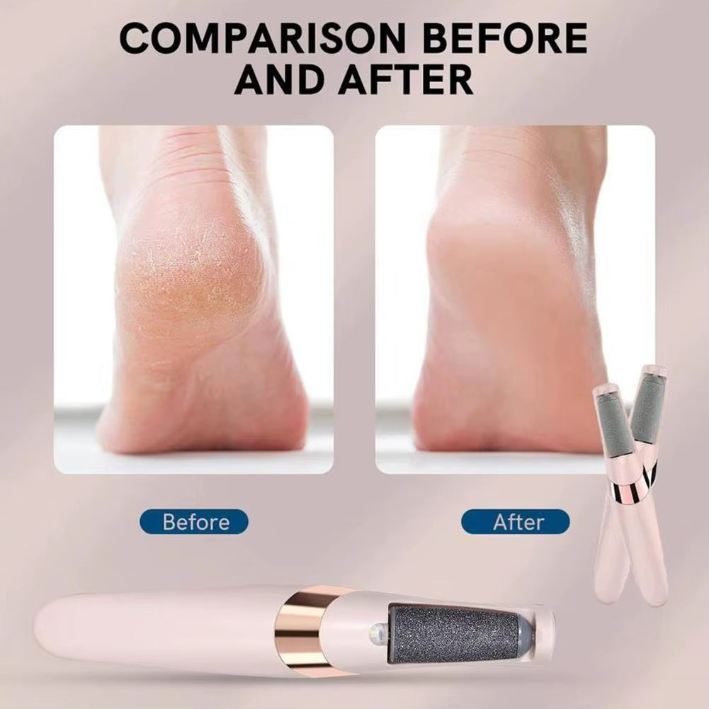 SoleGlow Remover