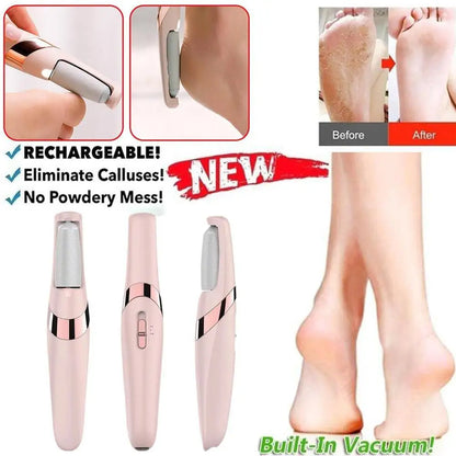 SoleGlow Remover