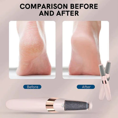 SoleGlow Remover